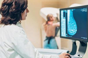 Mamografi Nasıl Çekilir ?