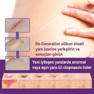 Re-Generation silikon sheet yara izlerinin görünümünü etkili bir şekilde azaltmaya ve cildinizdeki ameliyat, kesik, akne vb.izlerinin kötü görünümlerini ve oluşan kabarmaları geçirmeye yardımcı olmak üzere tasarlanmıştır.