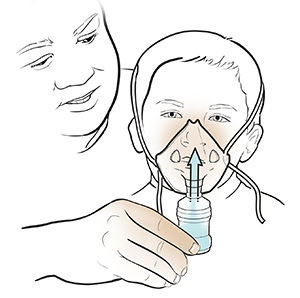 Nebulizatör Nasıl Kullanılır: Adım Adım Kılavuz