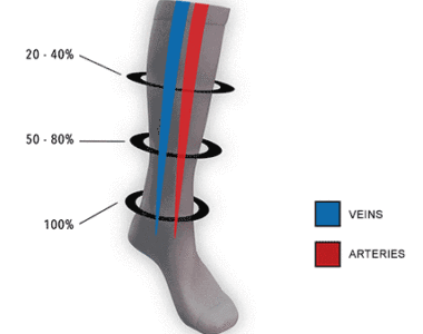 Varis çorabı seçimiVaris çorapları bacaklara ve ayaklara hafif, tutarlı bir basınç uygulayarak çalışır; bu da kan akışını iyileştirmeye, şişliği azaltmaya ve kaslara ve damarlara destek sağlamaya yardımcı olur.