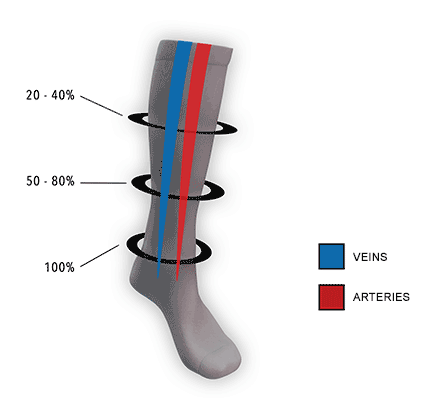 Varis çorabı seçimiVaris çorapları bacaklara ve ayaklara hafif, tutarlı bir basınç uygulayarak çalışır; bu da kan akışını iyileştirmeye, şişliği azaltmaya ve kaslara ve damarlara destek sağlamaya yardımcı olur.