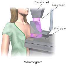 Mamografi Testi, göğüslerin iç görüntüsünü sağlayan bir X-ışını görüntüleme tekniğidir. Test meme kanserini tespit eder ve meme dokusunun büyüklüğünü, şeklini ve yoğunluğunu değerlendirir.