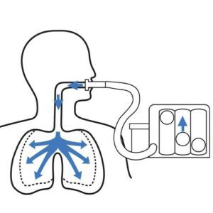 Nefes darlığının birçok sebebi olabilir örneğin astım, koah, anfizem ve bronşitin yanı sıra kuvvetsiz nefes almaalışkanlıkları, yaşlılık. Klinik bilgilere göre solunum kaslarımızı güçlendirmek nefes darlığını azaltmaktadır.