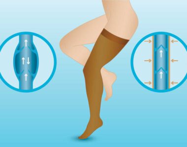 Varis Çorapları 1. Bu giysilerin derin ven trombozu veya pulmoner emboli gibi kan pıhtılarını önlediği tıbbi olarak kanıtlanmıştır . 2. Vücudun kanın bacaktan yukarıya doğru hareket etmesine yardımcı olarak size yardımcı olacaklardır. 3. Kompresyon giysileri venöz hastalık veya lenfödemin neden olduğu şişliği azaltır.