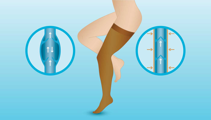 Varis Çorapları 1. Bu giysilerin derin ven trombozu veya pulmoner emboli gibi kan pıhtılarını önlediği tıbbi olarak kanıtlanmıştır . 2. Vücudun kanın bacaktan yukarıya doğru hareket etmesine yardımcı olarak size yardımcı olacaklardır. 3. Kompresyon giysileri venöz hastalık veya lenfödemin neden olduğu şişliği azaltır.