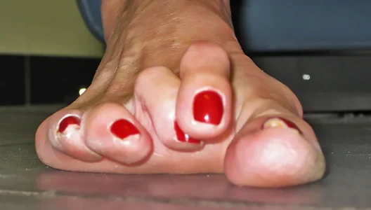 Çekiç parmak, el veya ayak parmaklarının istemsizce kıvrılması ile karakterize edilen bir durumdur. Bu deformite, parmağın bir çekiç şeklini alması ve ağrıya neden olmasıyla tanınır.